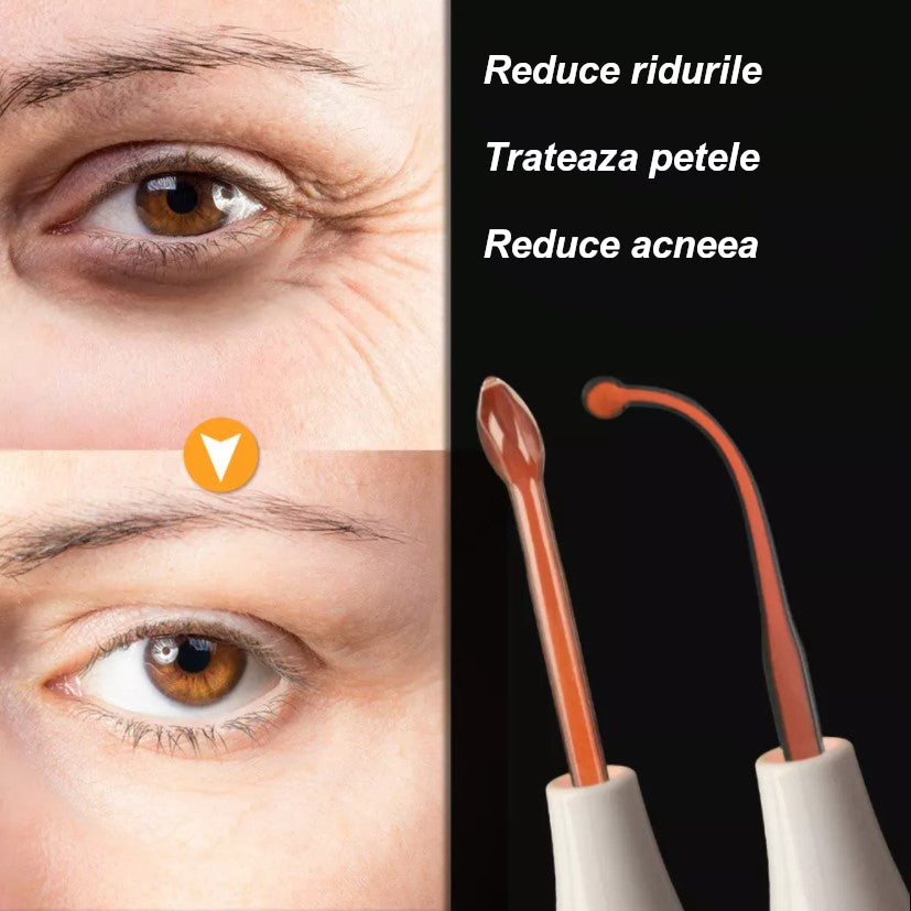 Aparat Electroderm Cosmetic 4 în 1 – Tratament Anti-Acnee, Riduri, Sebum și Îngrijire Ten