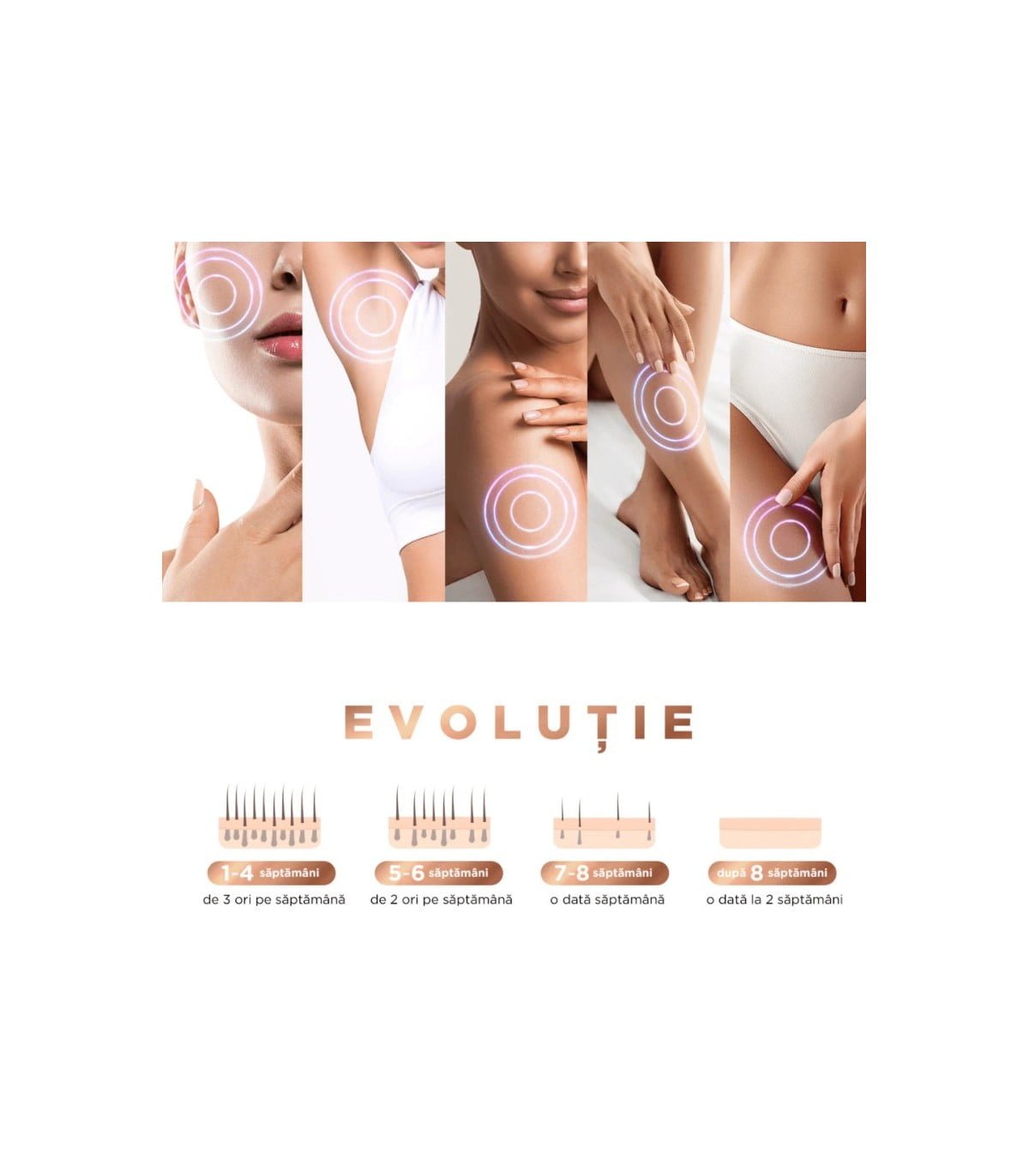 Epilator IPL, 300000 pulsatii, 5 trepte de intensitate, senzor piele, ochelari protectie - BUZ.RO