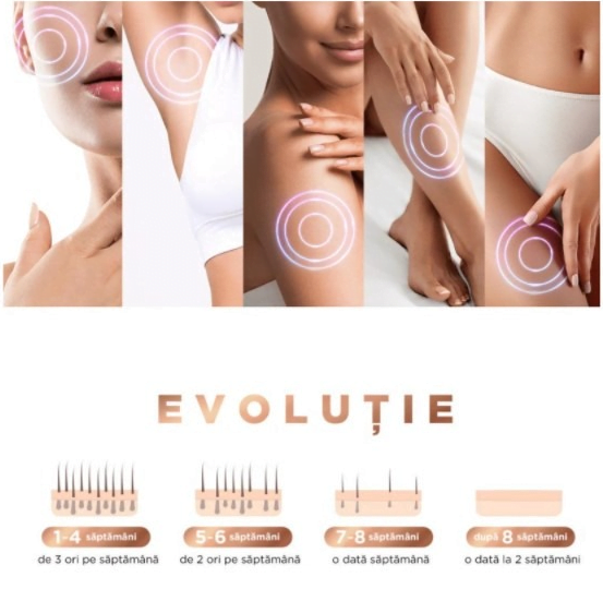 Epilator IPL, 300000 pulsatii, 5 trepte de intensitate, senzor piele, ochelari protectie