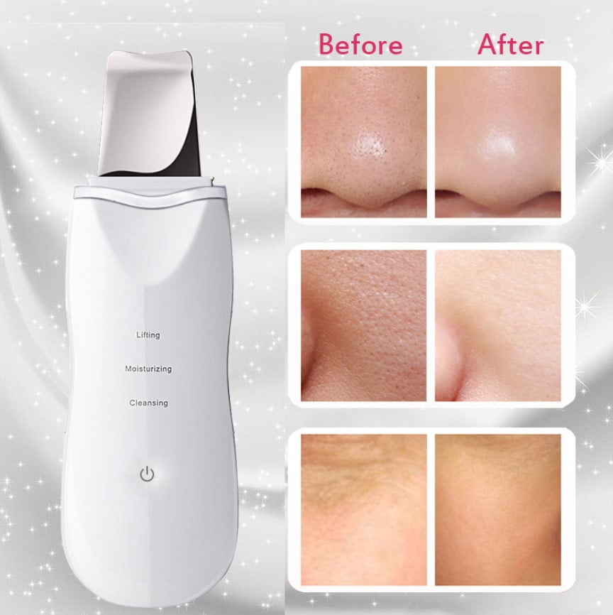 Aparat curatare faciala, ultrasonic, lifting ten, indepartare puncte negre, hidratare, skin scrubber, peeling, alb - BUZ.RO