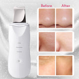Aparat curatare faciala, ultrasonic, lifting ten, indepartare puncte negre, hidratare, skin scrubber, peeling, alb - BUZ.RO