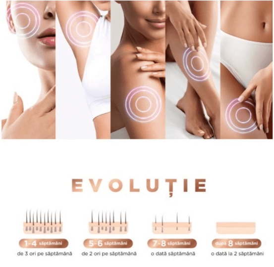 Epilator IPL, 300000 pulsatii, 5 trepte de intensitate, senzor piele, ochelari protectie - BUZ.RO