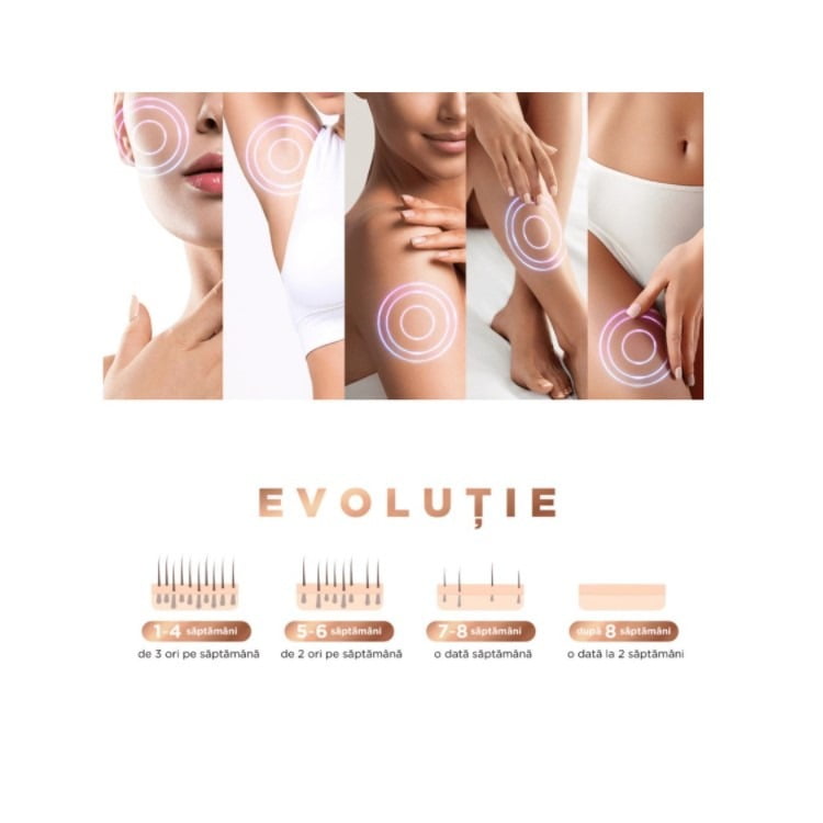 Epilator IPL, 300000 pulsatii, 5 trepte de intensitate, senzor piele, ochelari protectie