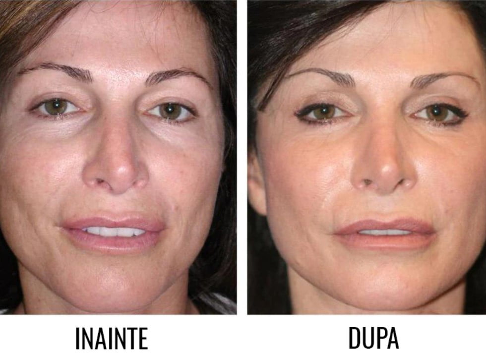 Masca faciala cu LED, tratament afectiuni ten, acnee, pete, riduri, grasime, 7in1